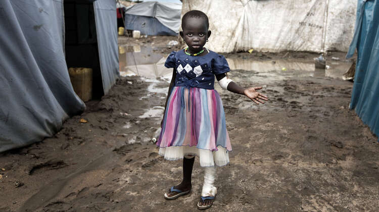Ein Mädchen in einem Flüchtlingscamp im Südsudan Ein kleines Mädchen mit Verbänden am linken Arm und linken Bein. Im Hintergrund sind Zelte zu sehen.